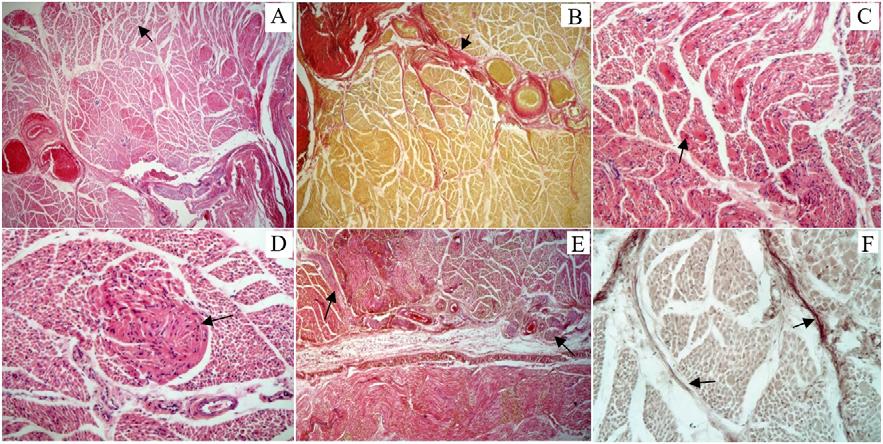 fibroneuromusculară Se determină impregnarea coloră cu orceină a fibrelor elastice la nivelul zonei cutanate şi de frontieră fibromusculară; B - pliu conjunctiv vascular - impregnare coloră cu