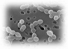 Heteropolizaharidele Produse de bacterii Dextranul Ind.