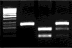 de 2% a produselor PCR rezultate din amplificarea ADN uman cu primeri