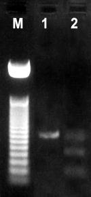 M marcher al lungimii; 1 genotip I/D; 2 genotip D/D; 3 genotip I/I.