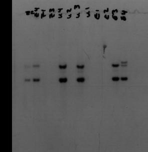 Identificarea mutaţiilor punctiforme ce afectează SR Dactiloscopia genomică RFLPs Denaturarea şi transferul ADN pe membrane Hibridare cu sonda Autoradiografia