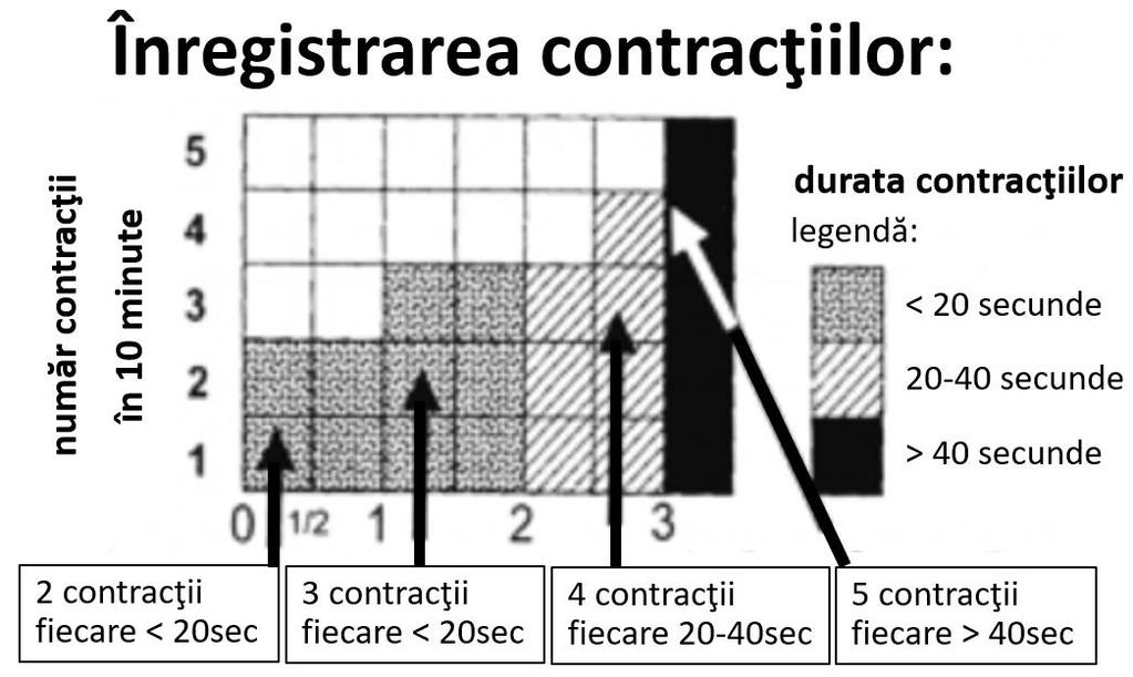 Figura 2. Înregistrarea frecvenţei şi lungimii contracţiilor. Numărul pătratelor completate reprezintă numărul contracţiilor în 10 minute.