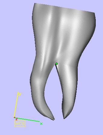 Fig. 5.11. Molar mandibular - vedere 3D [BUI16] Fig. 5.12. Molar mandibular - secțiune în vedere 3D [BUI16] Modelul 3D al molarului mandibular a fost realizat în sistemul CAD, SolidWorks.