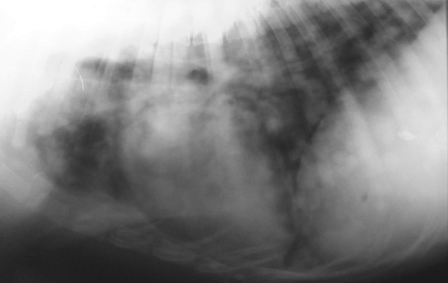 Fig. 6 Metastaze pulmonare Abcesele pulmonare - prezintă un perete gros şi o suprafaţă neomogenă; - ele pot fi cavitare dacă conţin gaz (bacterii producătoare de gaz sau dacă sunt conectate la căile