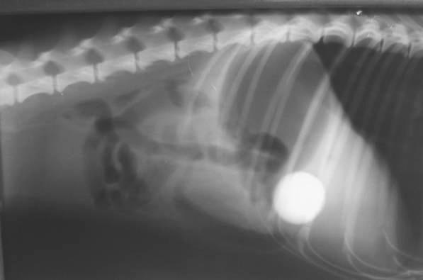 Obstrucţia pilorică Modificări radiografice radiografie simplă: - stomacul apare destins de fluide, ingestă sau gaze; -
