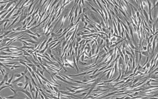 pasaj 35-42 endoteliu vascular - reprezentat in modele experimentale de linia celulara standardizata HUVEC celule primare endoteliale umane