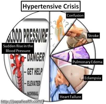 Crizele hipertensive (2) Urgenta hipertensiva majora - crestere importanta a TAs si TAd (de obicei Tas>180 mm Hg si Tad>120