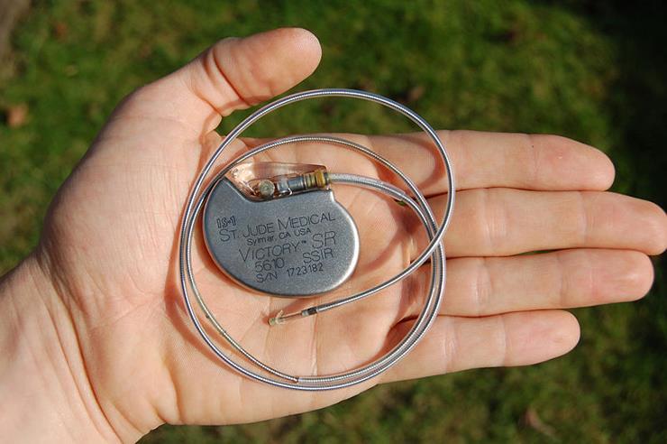 Pace maker permanent Electrozi epicardici - frecvent la copii cu G< 10 kg - device implantat in regiunea abdominala