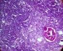 Histopatologic se relevă modificări în centrii germinativi ai timusului, splinei şi de aici explicaţia plauzibilă pentru inducerea limfocitopeniei de către OTA (19, 20).