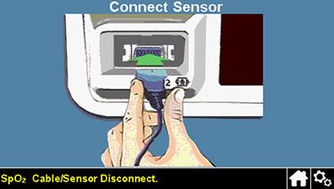 Dacă senzorul se deconectează de la sistemul de monitorizare Dacă senzorul se deconectează de la sistemul de monitorizare, apare ecranul afişat în