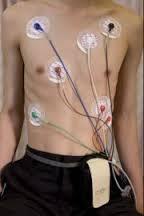 Monitorizare Holter EKG pe 24-72 h Investigatie