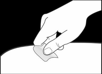 Nu injectaţi în zone în care pielea este sensibilă, învineţită, înroşită sau îngroşată. Nu injectaţi în zona de 5 cm (2 inci) din jurul buricului. Curăţaţi locul de injectare Spălaţi-vă mâinile.