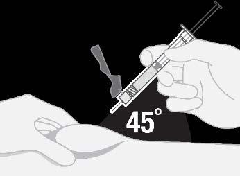Injectarea Hulio Pasul 12 Pregătiţi locul de injectare Ştergeţi pielea la locul de injectare ales cu un tampon cu alcool nou.