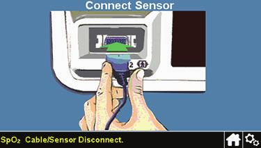 Dacă senzorul se deconectează de la sistemul de monitorizare Dacă senzorul se deconectează de la sistemul de monitorizare, apare ecranul prezentat în partea