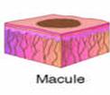 Tipuri de erupții cutanate macula: pată colorată nereliefată < 0,5-1 cm diametru papula: infiltrare dermică, proeminentă