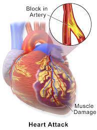 cardiacă (49%), alcaloză (40%), hiperkaliemie (37%),