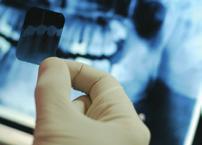 un alt cabinet. Radiografia dentară este un element esențial al diagnosticului stabilit de medicul stomatolog.