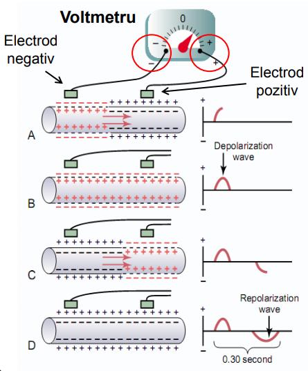 Înregistrearea undelor ECG Diferentele de potential produse de activitatea electrica a inimii sunt masurate de voltmetre Prin conventie, daca electrodul conectat la borna pozitiva se afla in zona de
