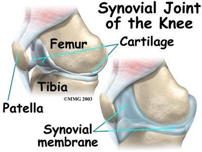 Exista mai multe metode de tratament pentru artroza de genunchi (gonartroza).