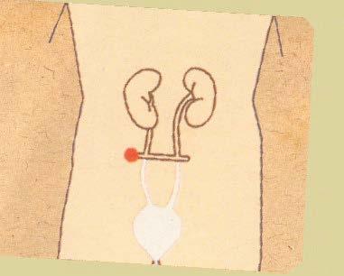 cazul unei îngrijiri  Urostomii deschideri ale tractului urinar