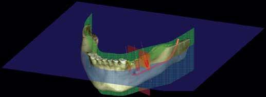 Conferință Septembrie 18/19/20, 2015 9 Tematica hands-on endodontie: Anatomie secțională 2D și 3D, variante anatomice utile pentru diagnosticul și tratamentul