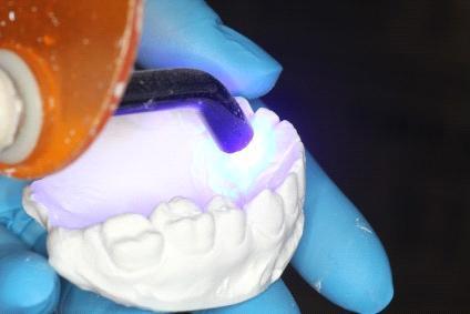 Dintele se fixează pe model în noua poziție dorită cu un compozit flow, astfel încât să fie perfect încadrat în arcada dentară în