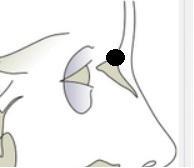 Punctul unde se unesc cele trei reprezintă Nasion; Aplicaţii: Nasion se utilizează ca punct de referinţă în construirea unghiurilor şi planurilor care evaluează: Relaţia maxilarului faţă de baza
