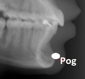 alveolar mandibular, între Id şi Pog Punct anatomic, osos, median Localizare: se trasează conturul