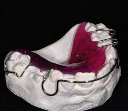 ortodontice Stahl