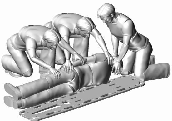 3. Încărcarea pacientului în poziția culcat pe spate pe targa rigidă Această manevră trebuie efectuată de cel puțin trei salvatori (Res.). Res. 1 și Res.