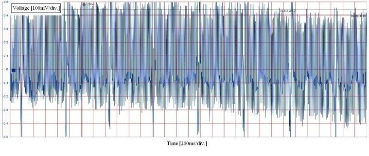 Fig 4.2.9 Semnal EKG acoperit de zgomot [34] Figura 4.2.10 Filtrare EKG cu MAX 7426 [34] Tabelul 4.2 prezintă valorile calculate pentru filtrul de ordin 6 iar Tabelul 4.