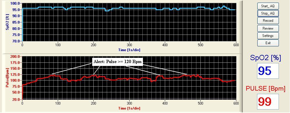 Figura 4.3.7 Monitorizare la efort bărbat 35 de ani Test 2 [7] TABEL 4.3.1 - TEST 1 TABEL 4.3.2 TEST 2 Descriere Eveniment Timp interval [s] Descriere eveniment Timp interval [s] Urcarea scărilor cu scurte pauze [0 460] Urcarea scărilor cu scurte pauze [0 495] Fig.
